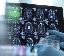 A person wearing blue gloves examining brain scans